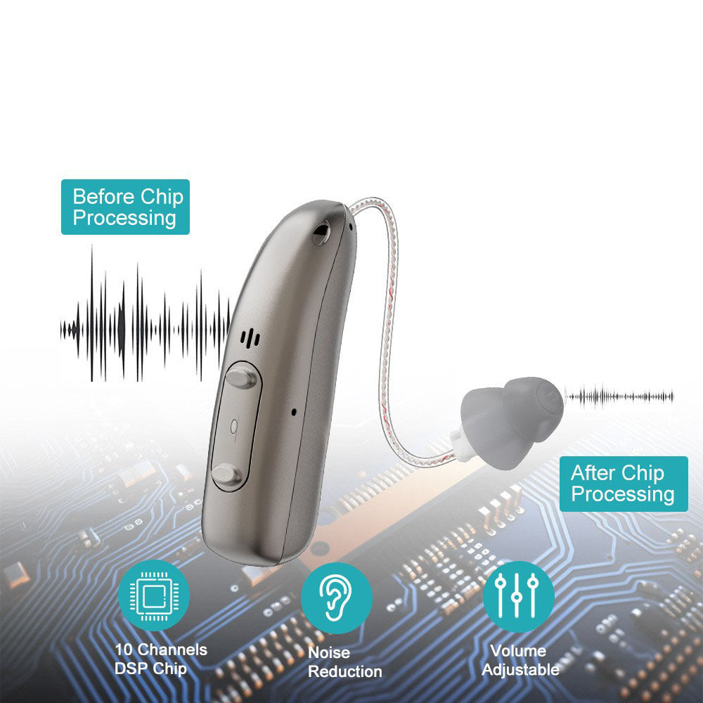 🔥Anakil™ Smart Sound Support - Hear Clearly Again | 60% OFF